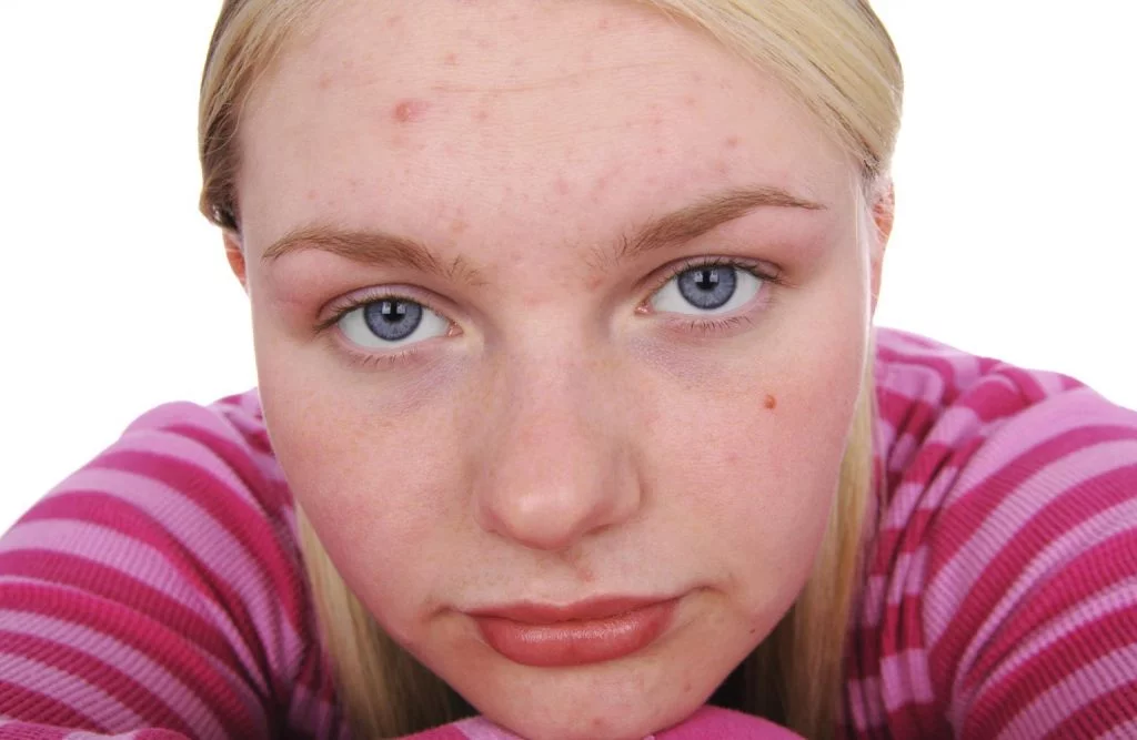 Curso de Dermatología Básica GRATIS